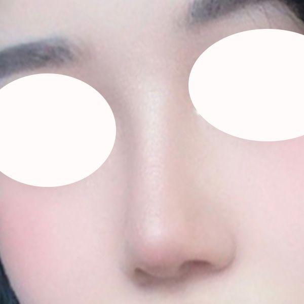 后