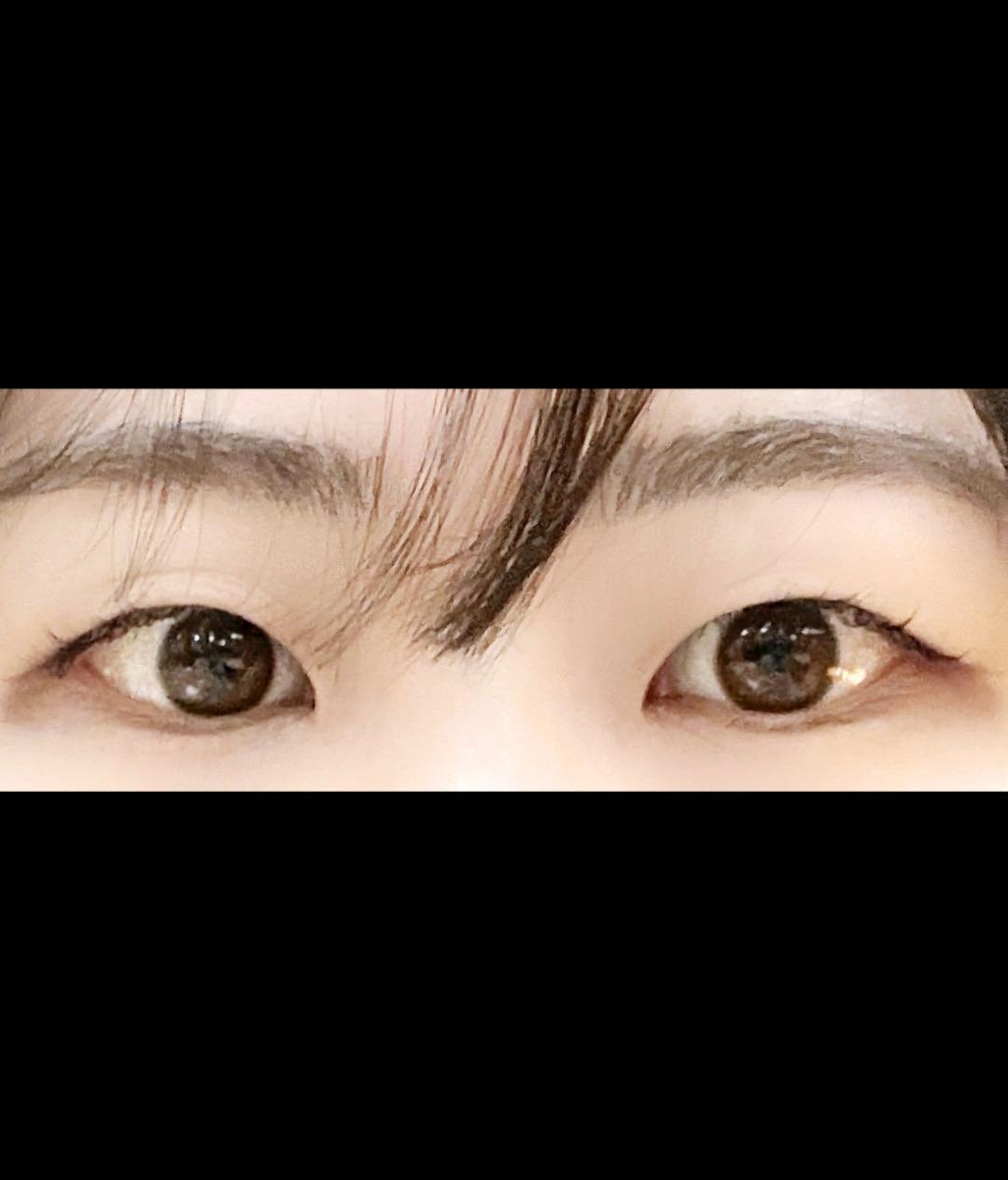 後