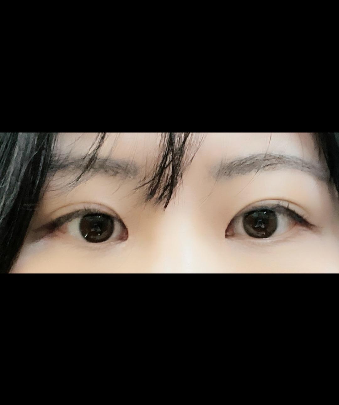 後