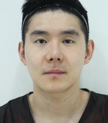 後