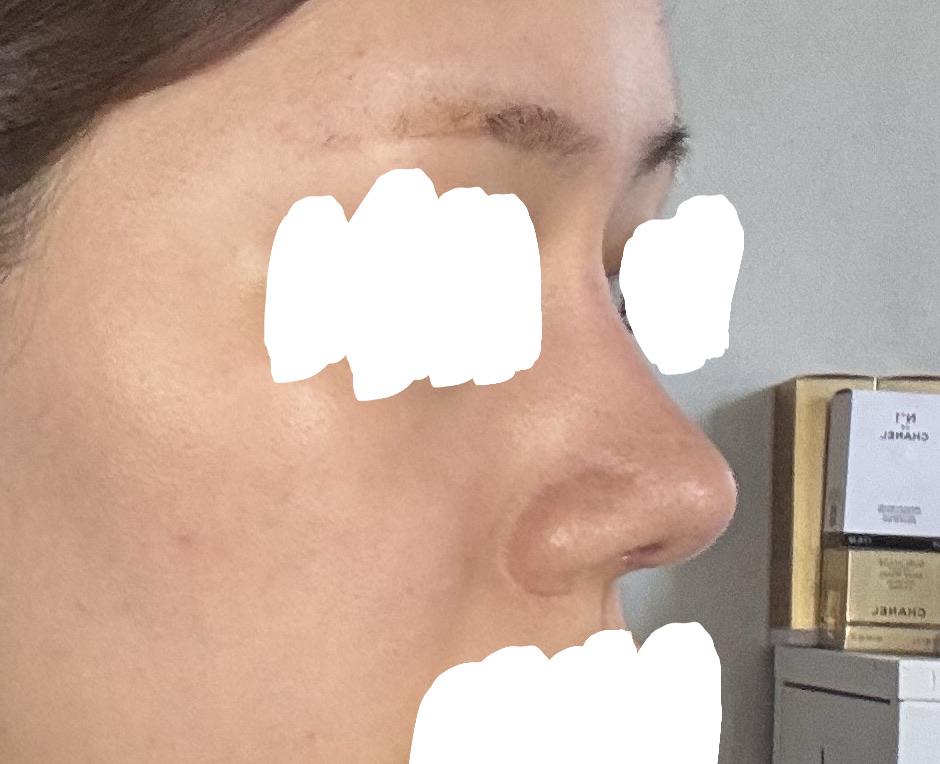 后