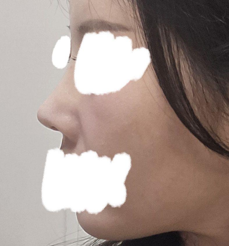後