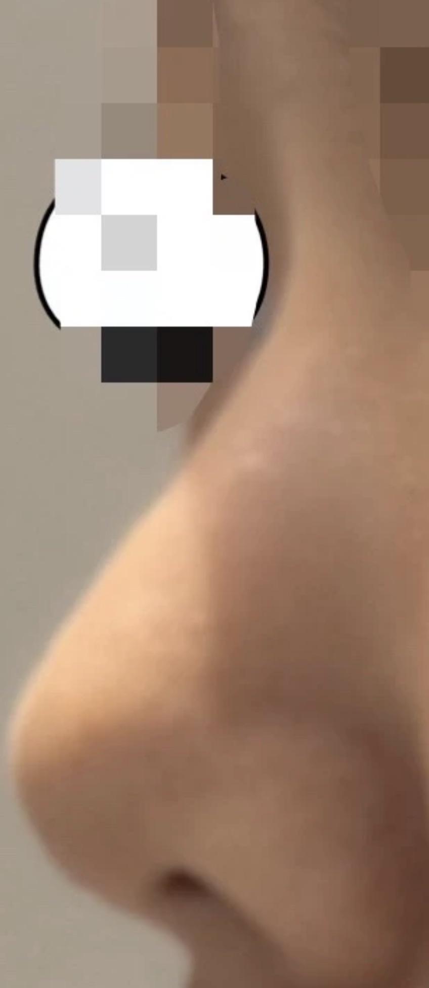 前