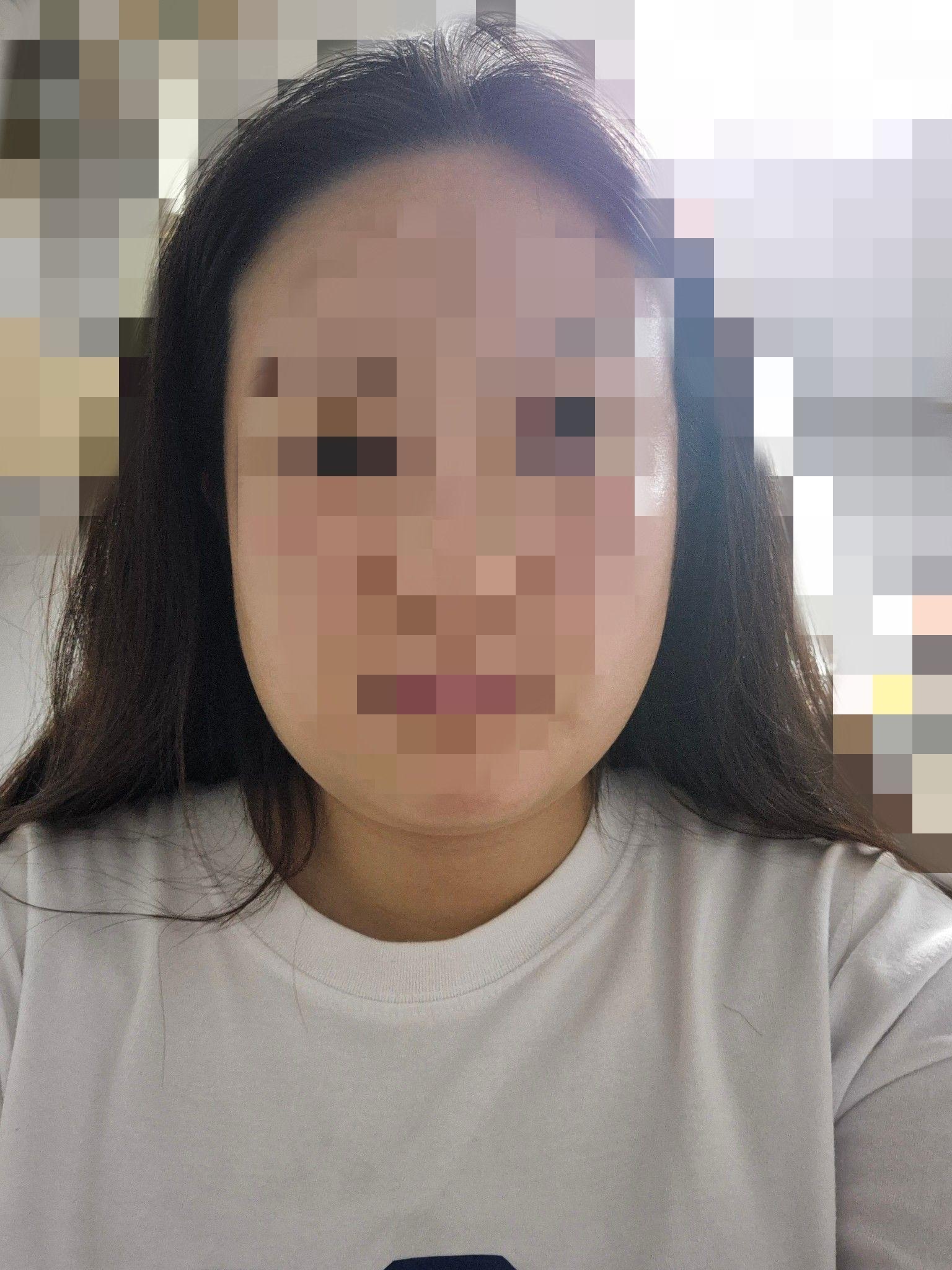 後