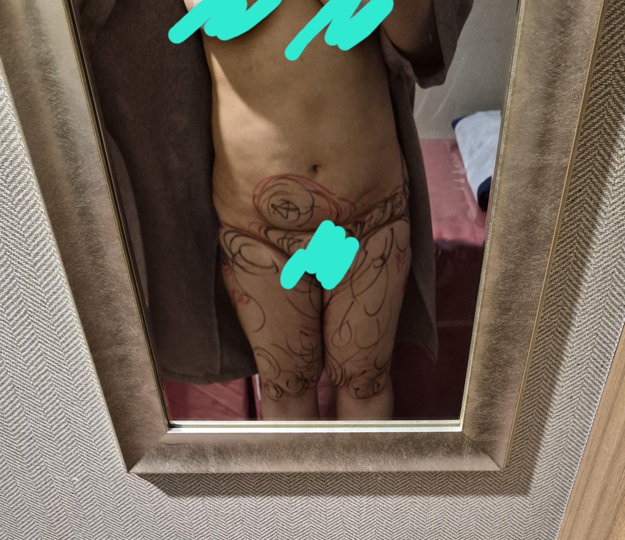 後