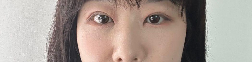 後