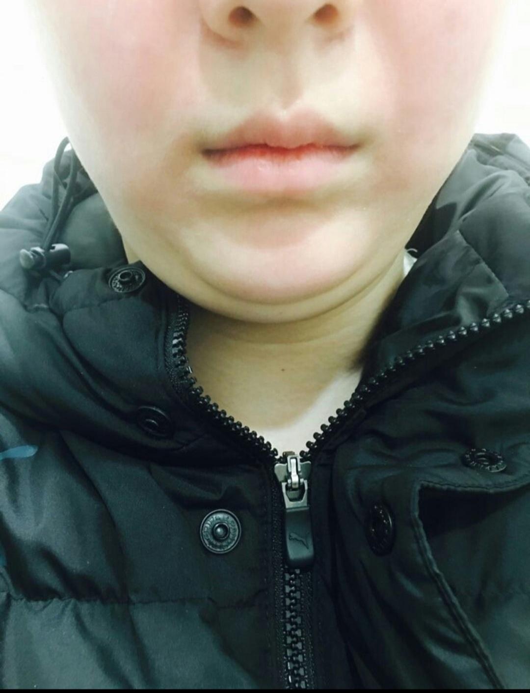 後