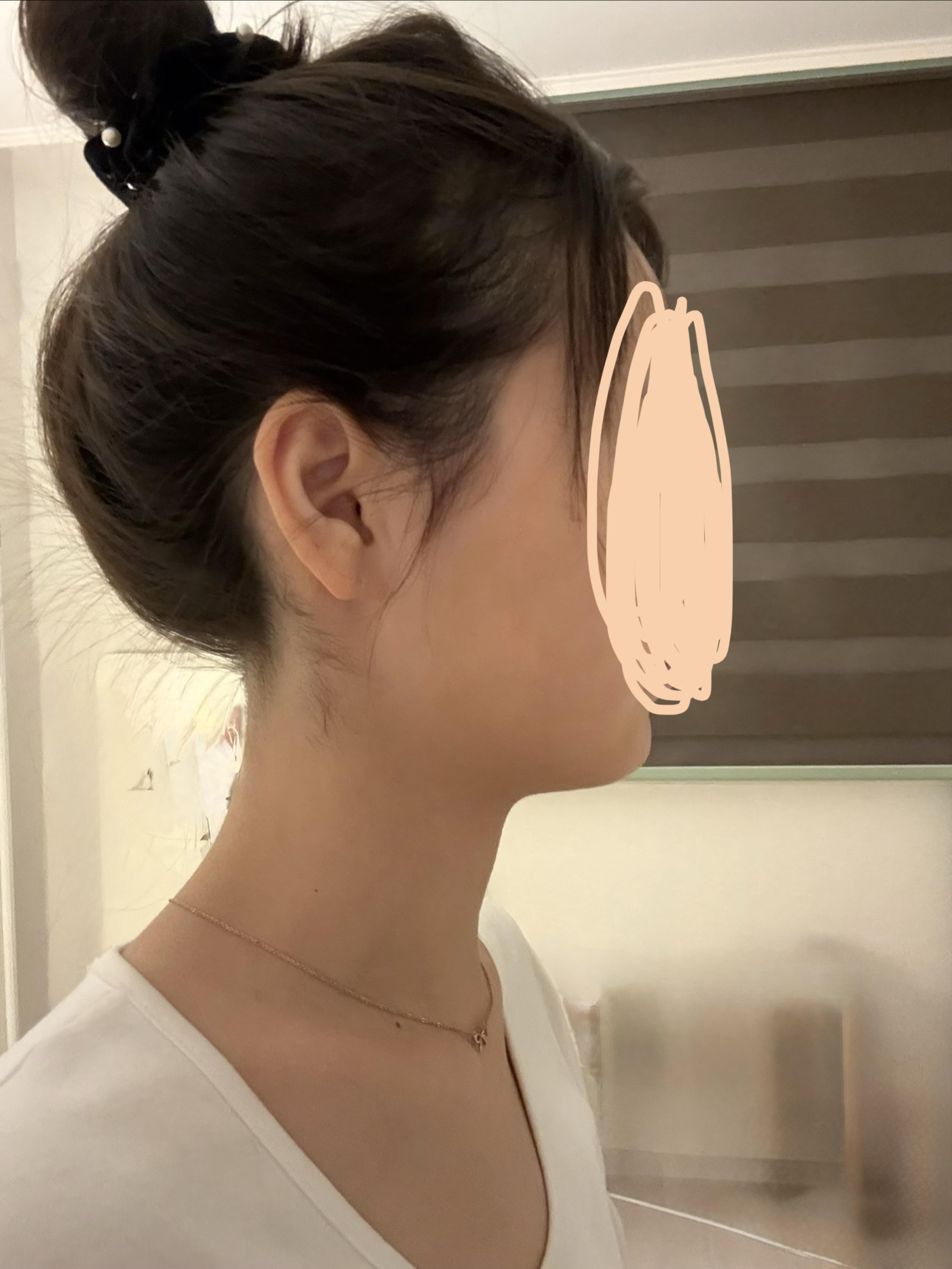 後