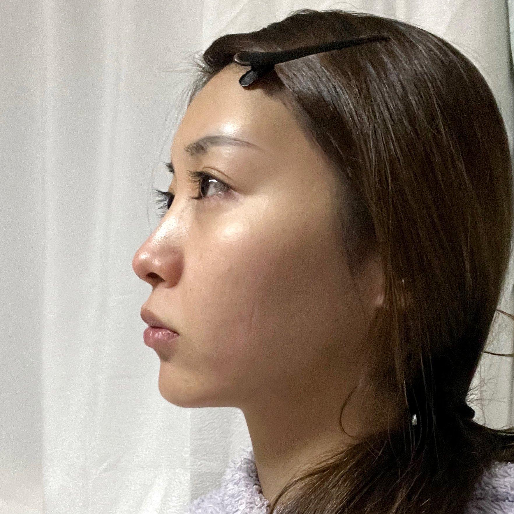 後