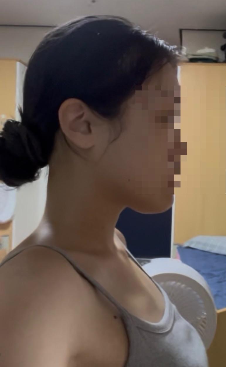 後