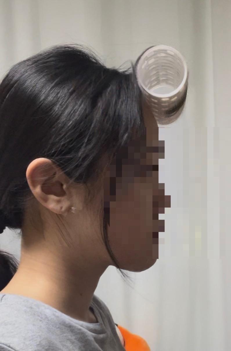後