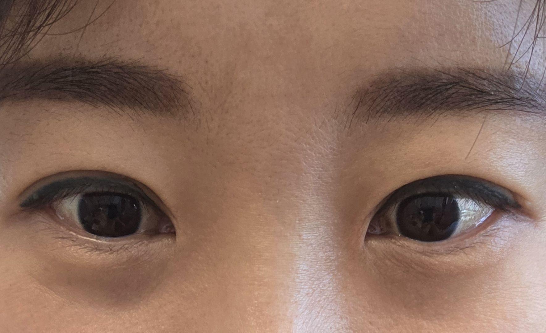 後