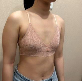 後