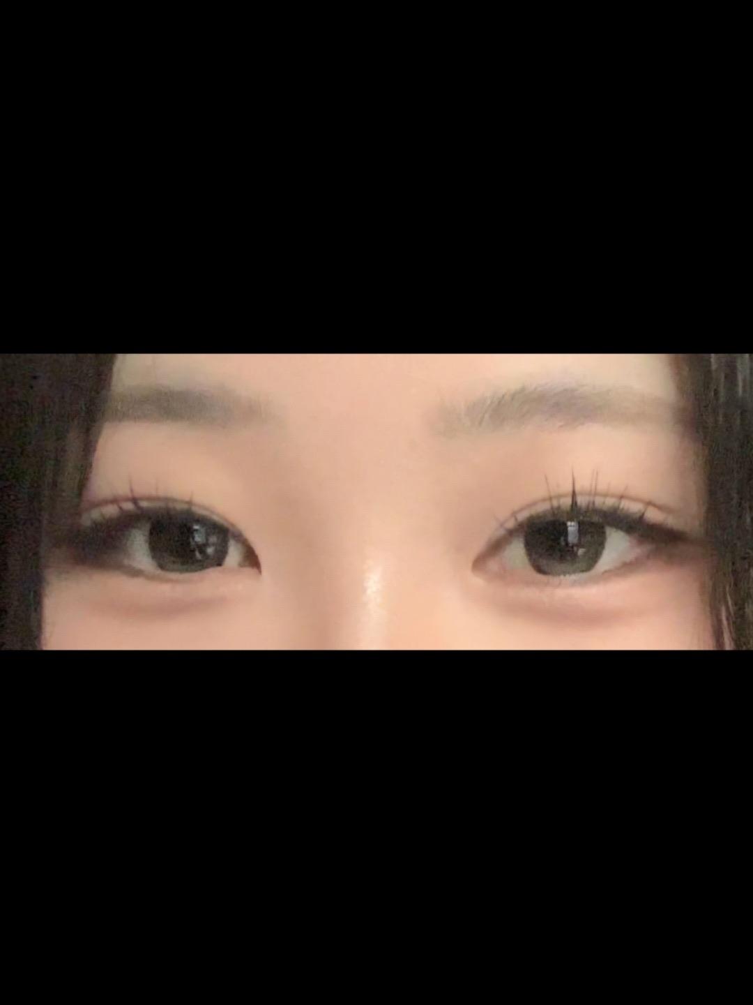 後