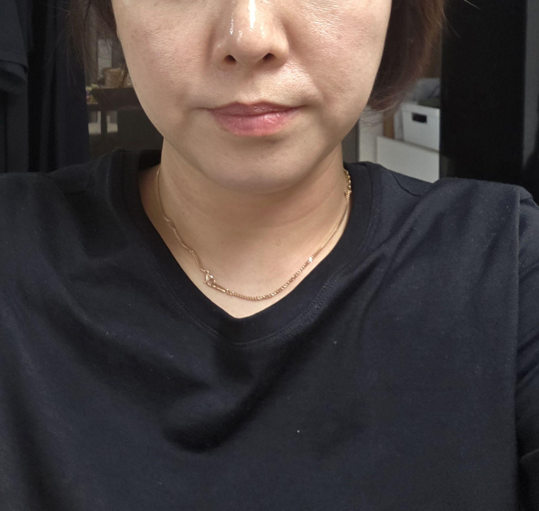 後