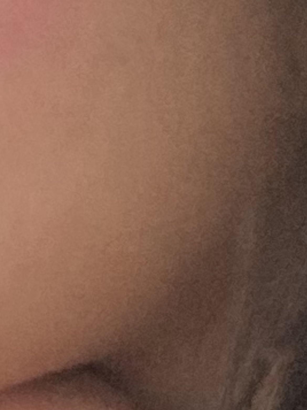 後