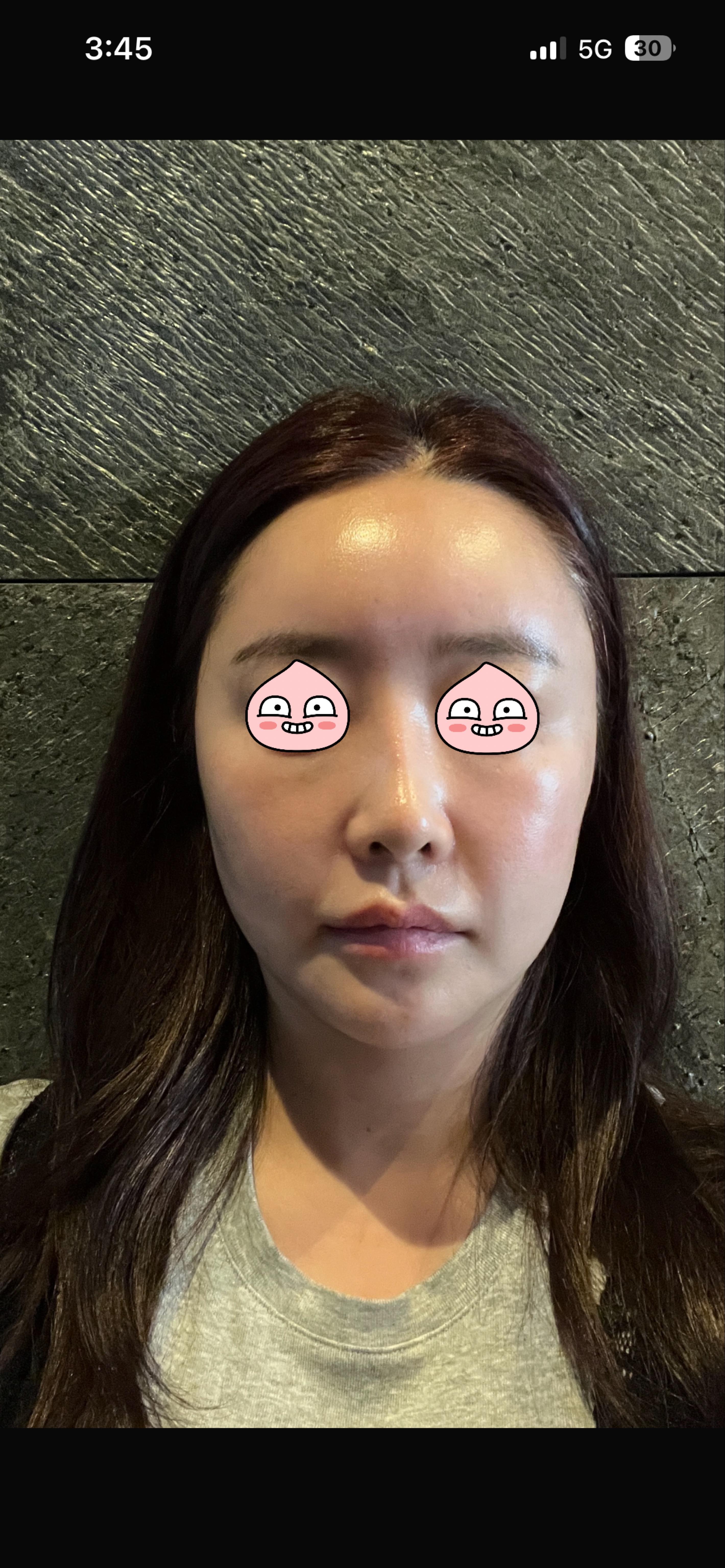 前