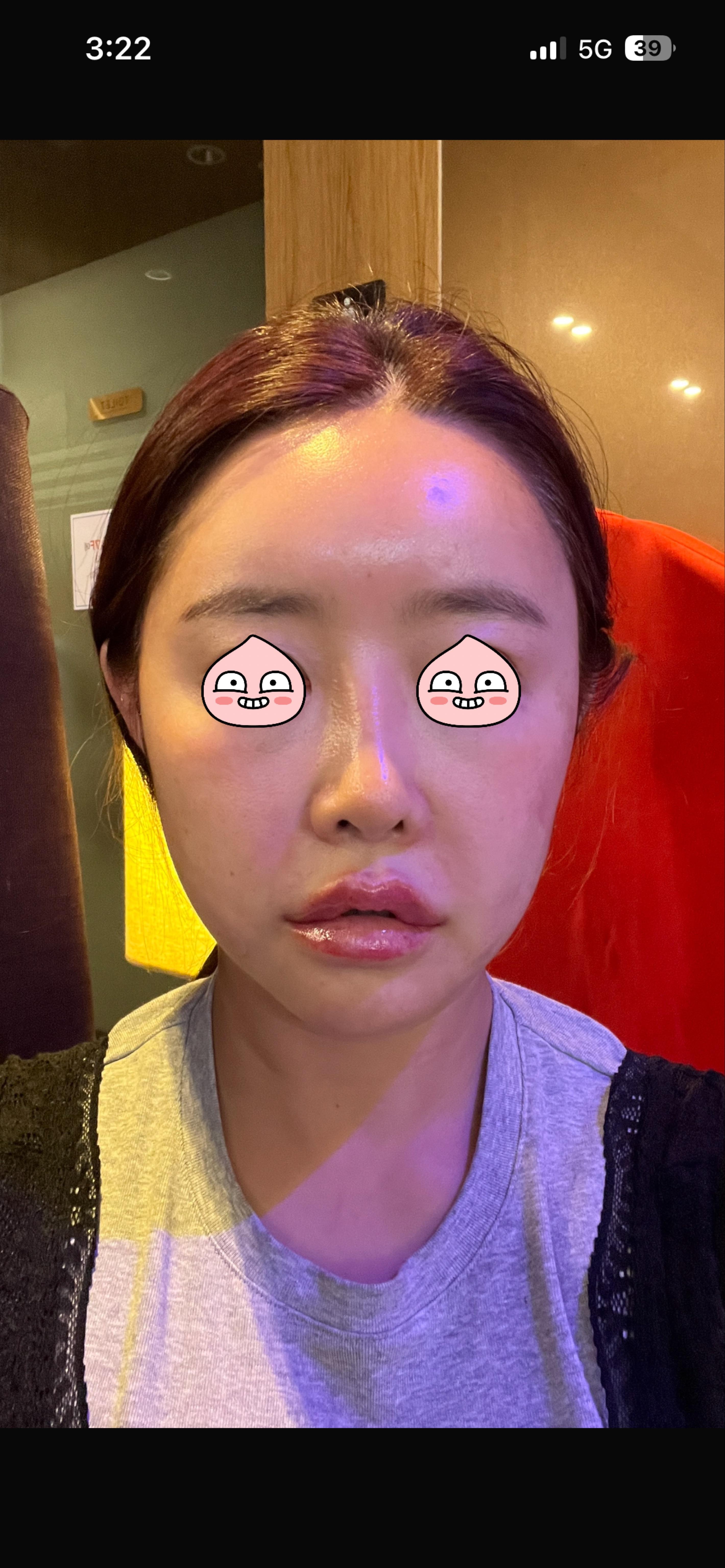 後