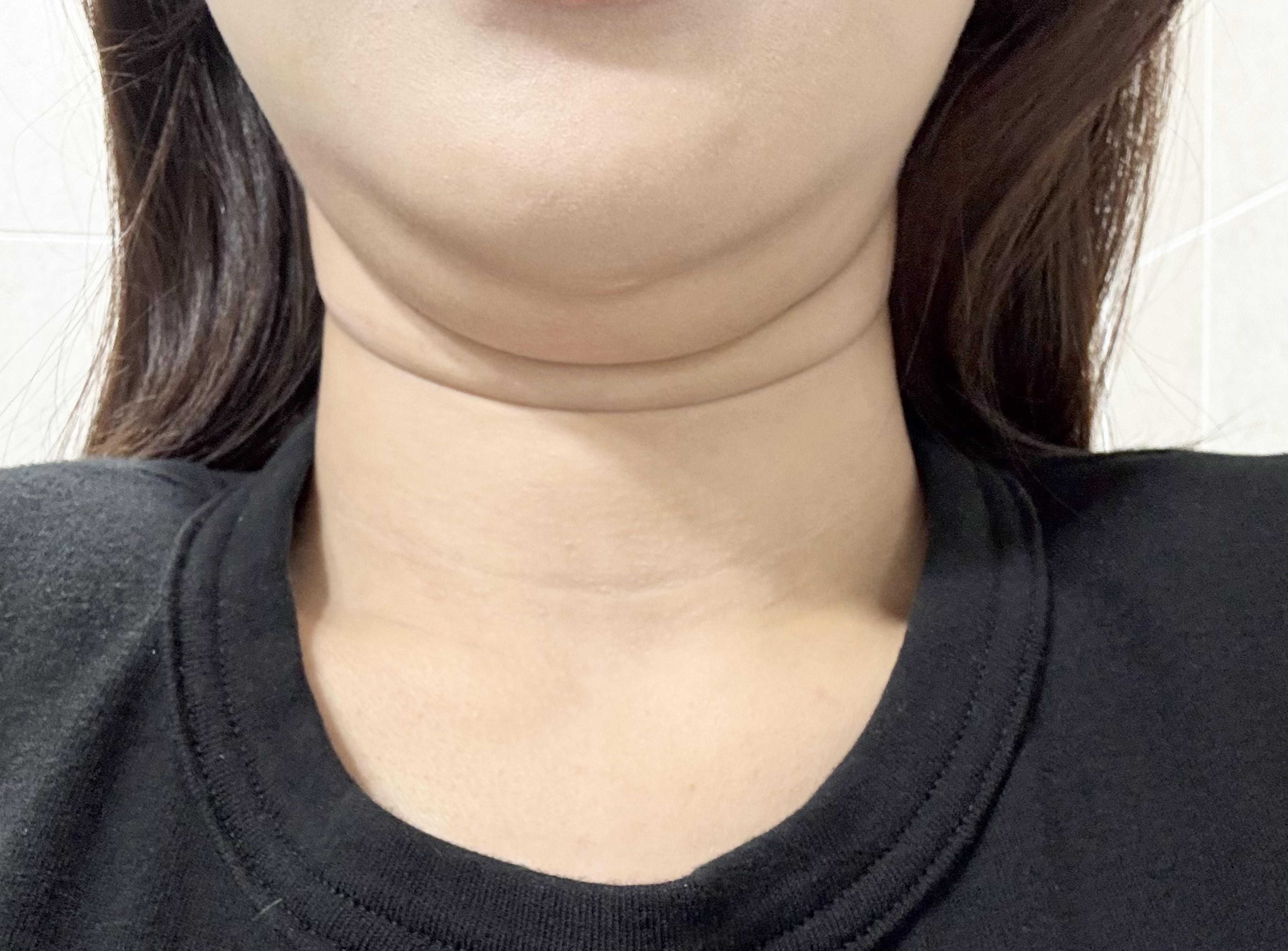 後