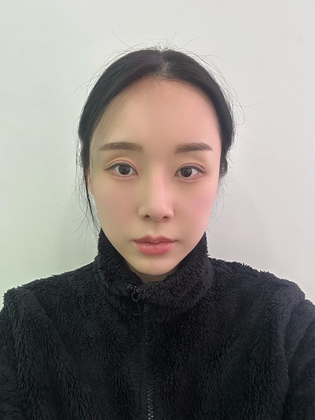 後