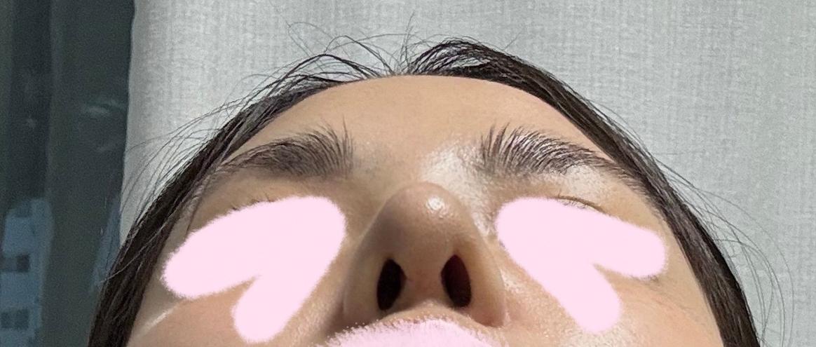 後