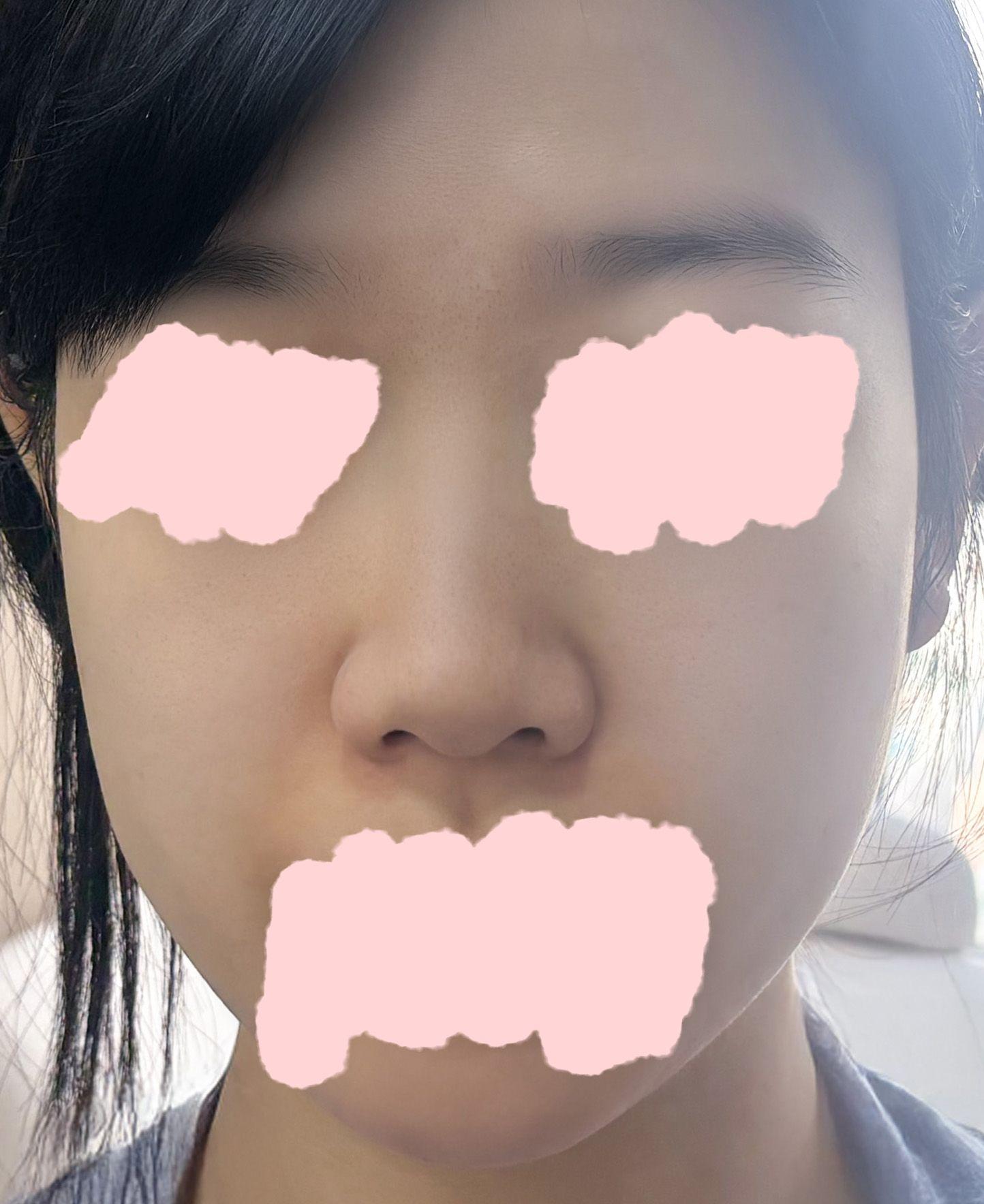 後