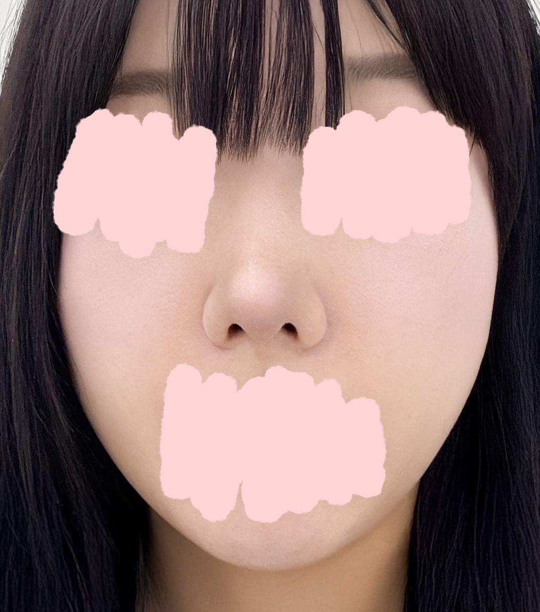 後