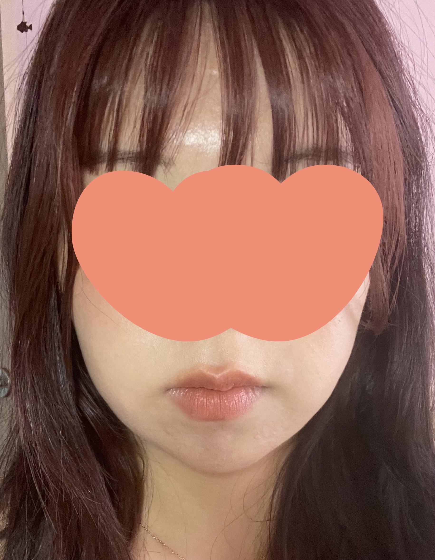 後