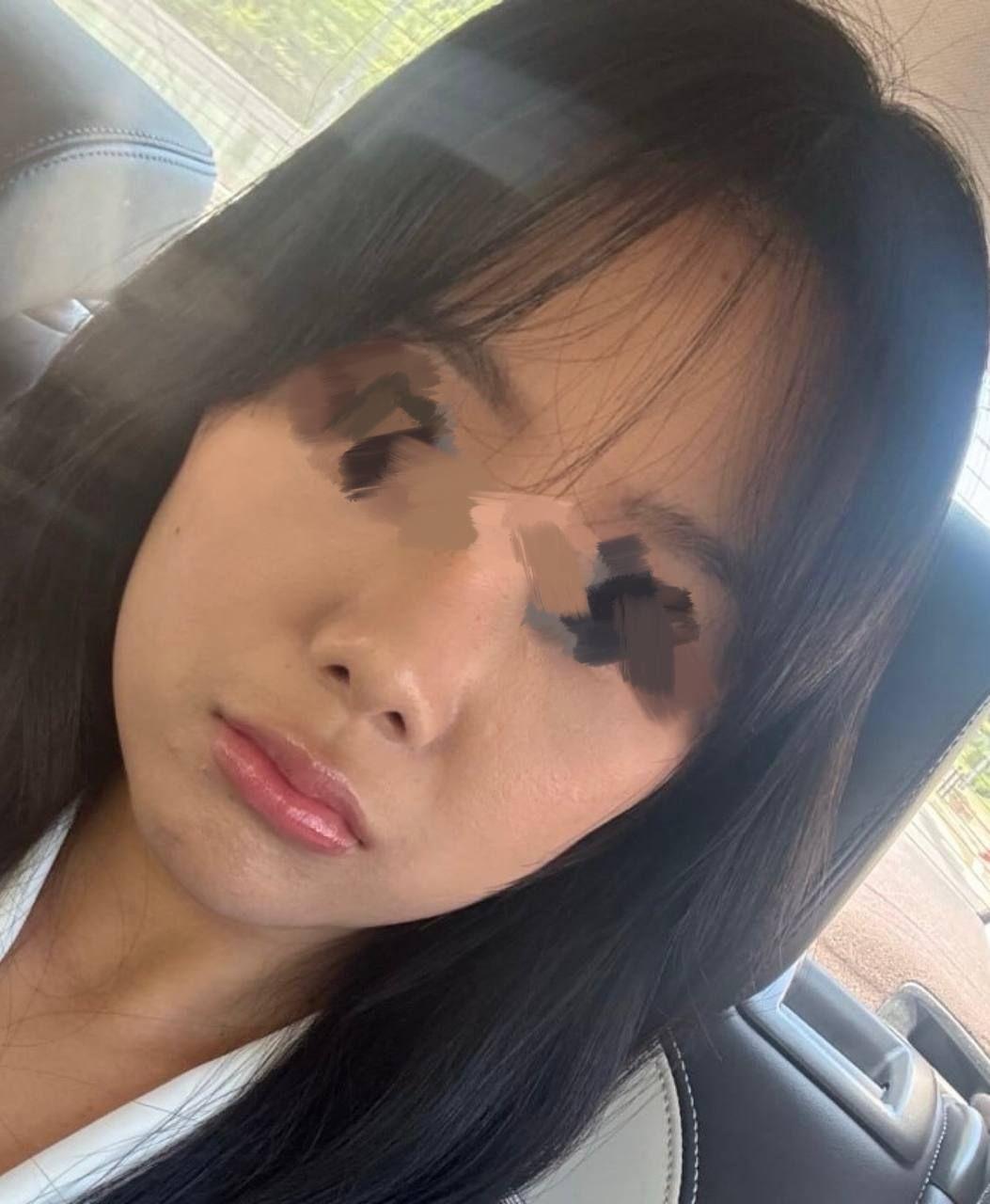 後
