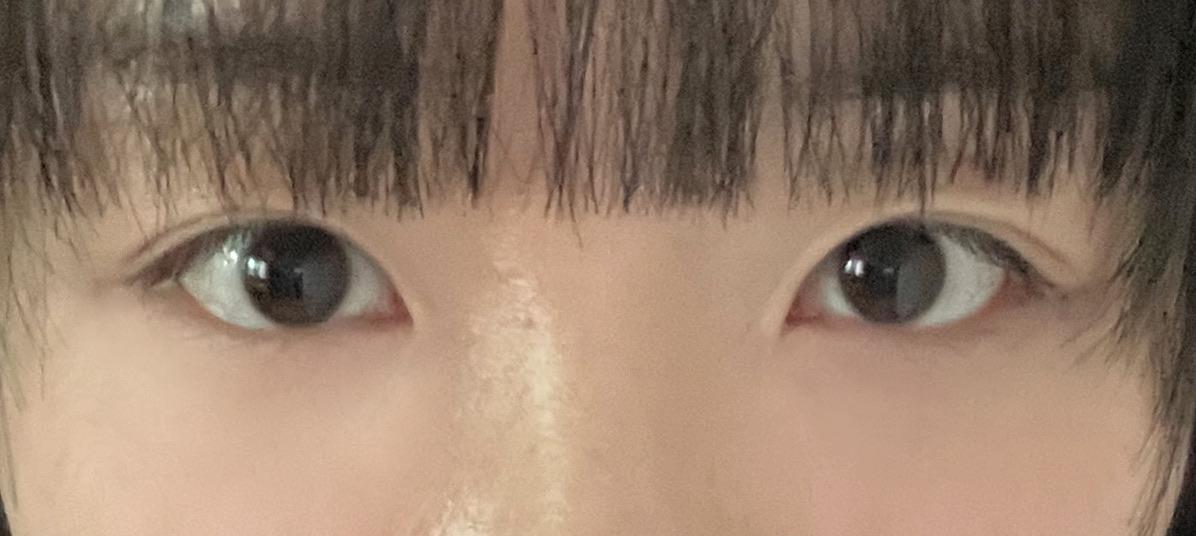 後