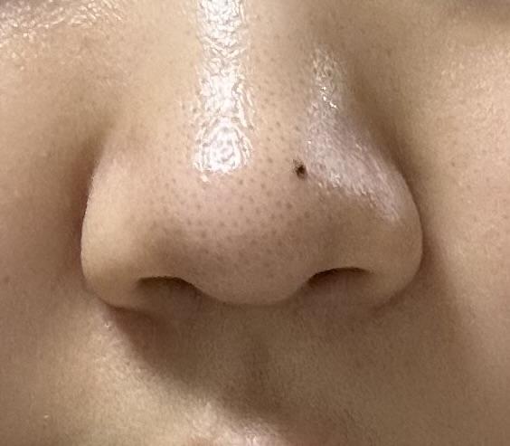 後