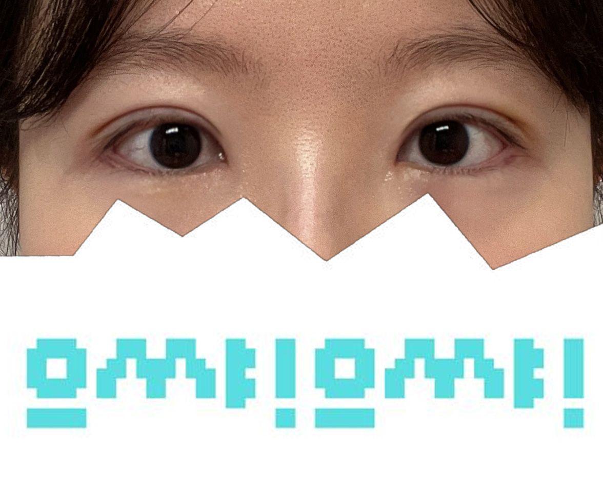 後