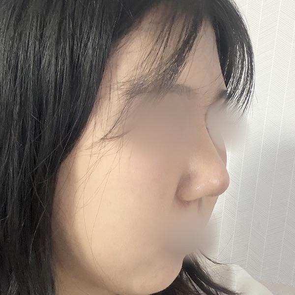 後