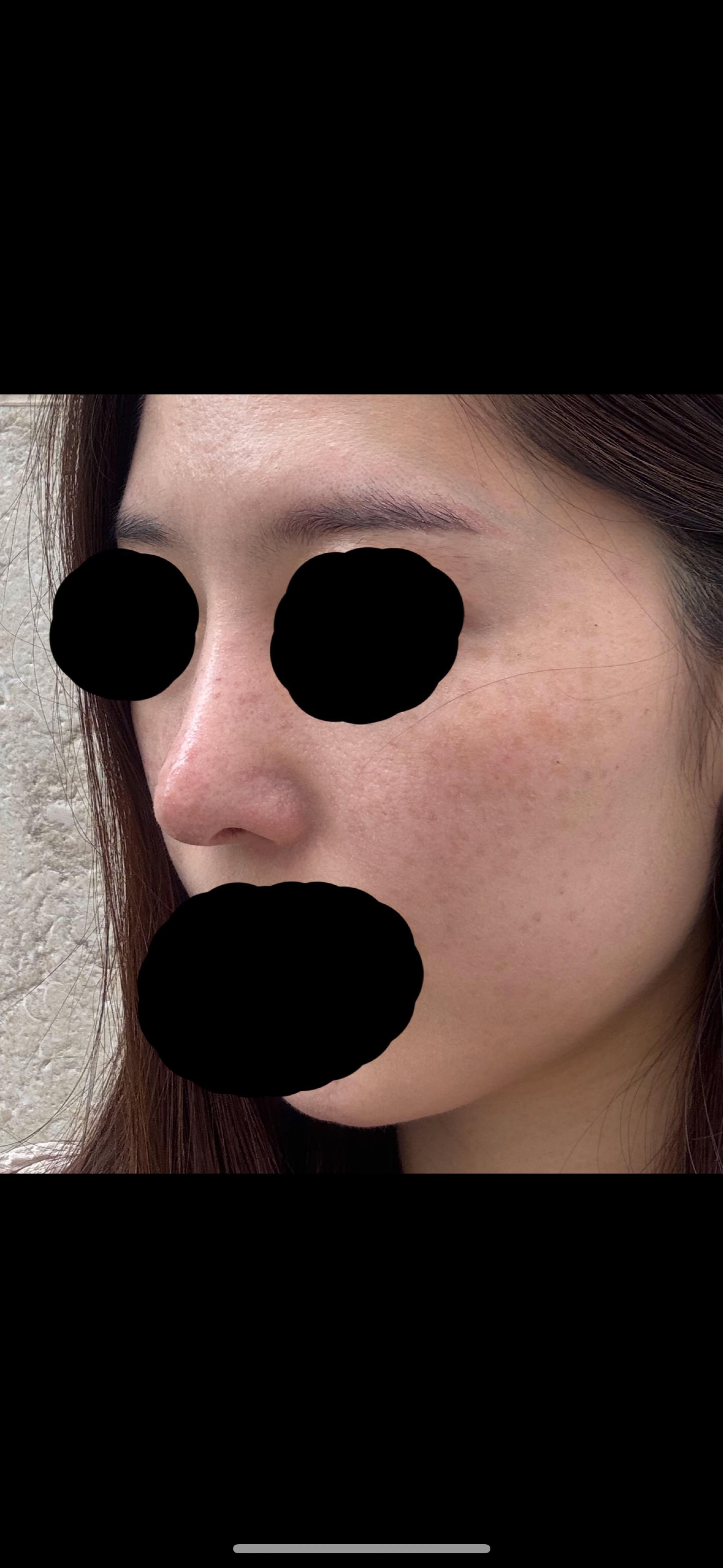 後