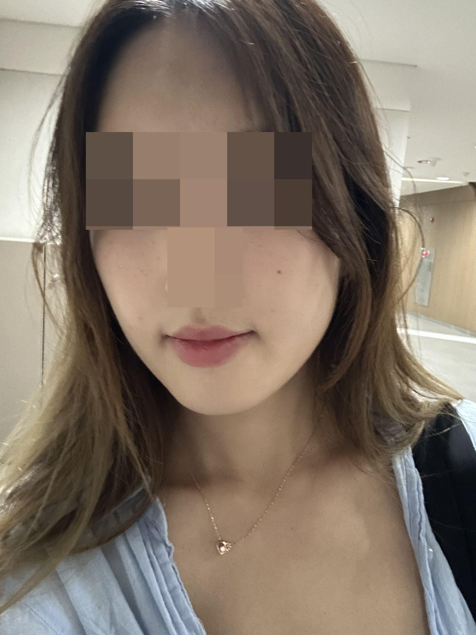 後
