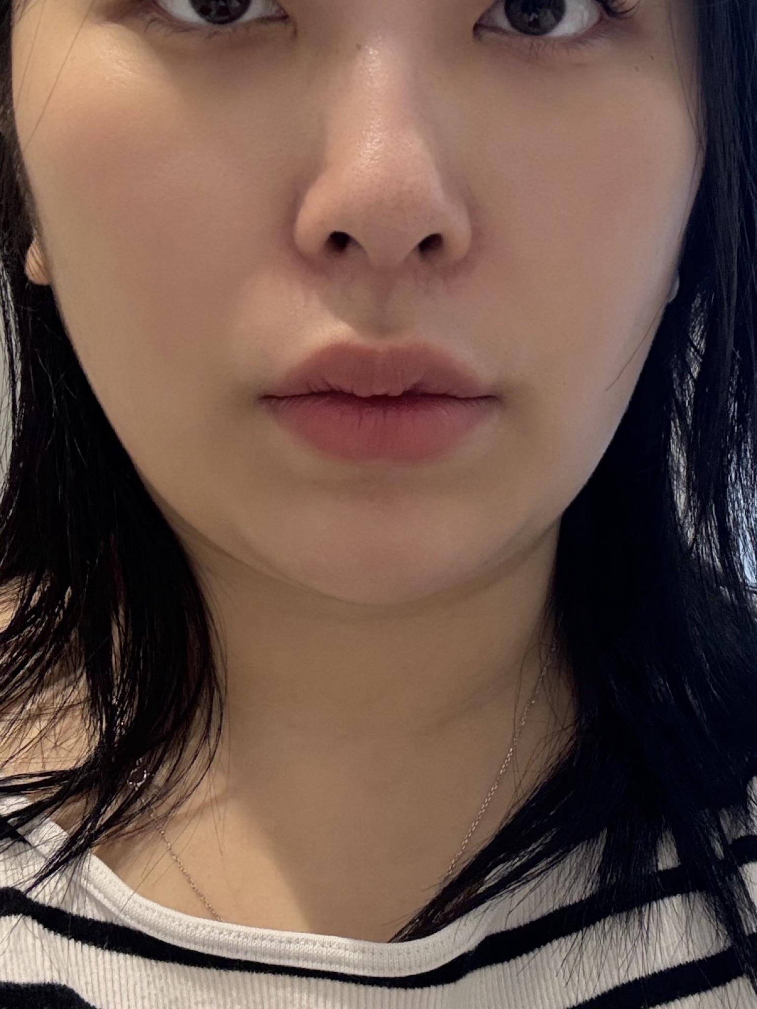 後