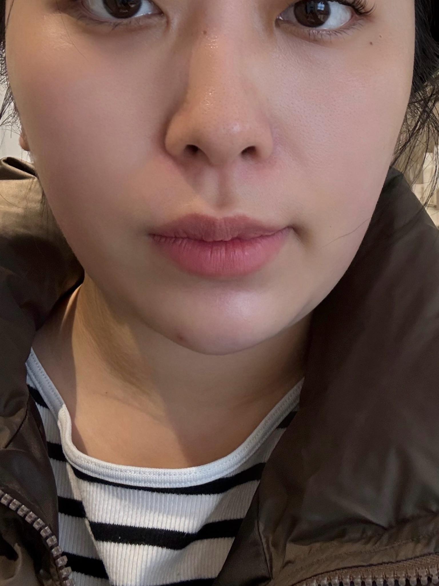 後