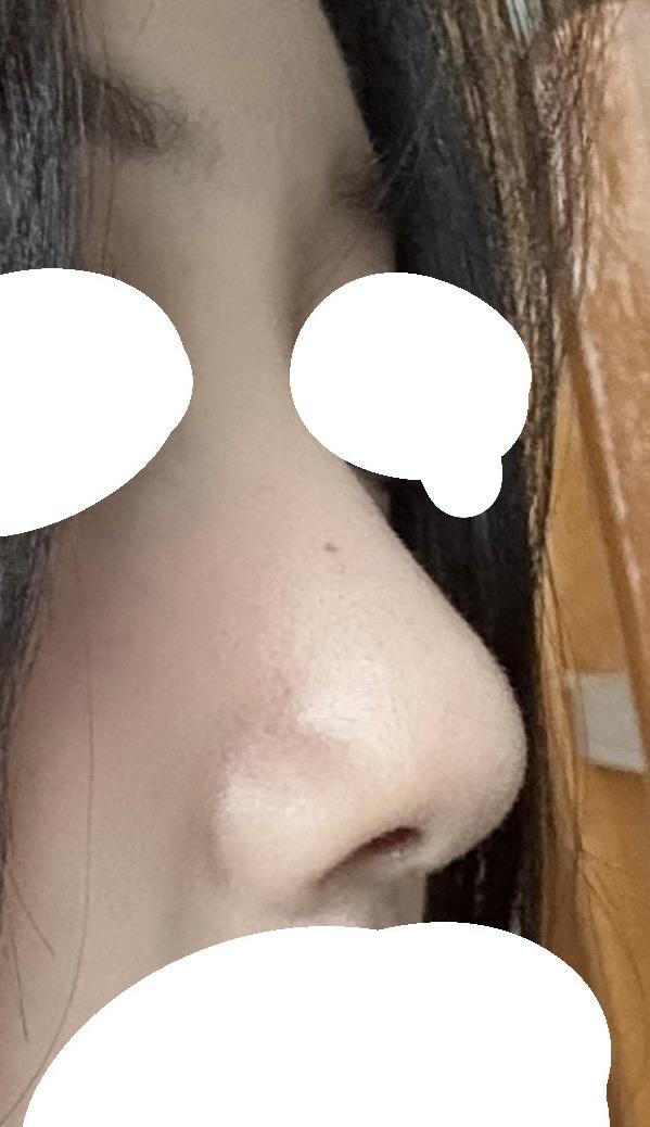 後