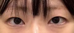 後