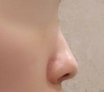 後