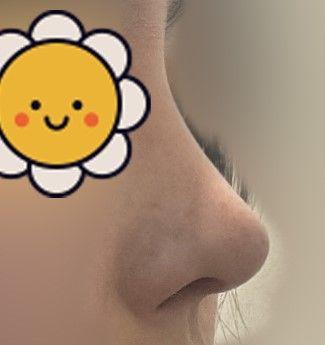 後