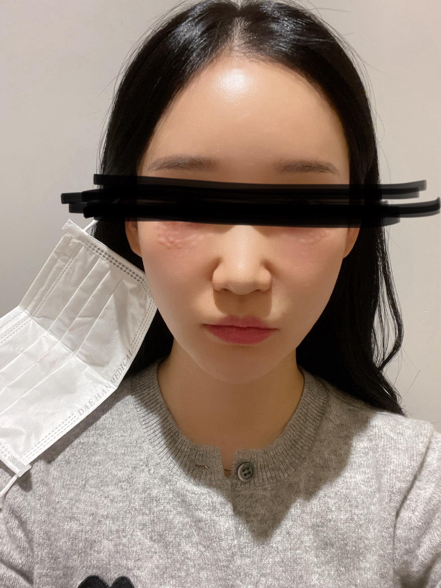 後