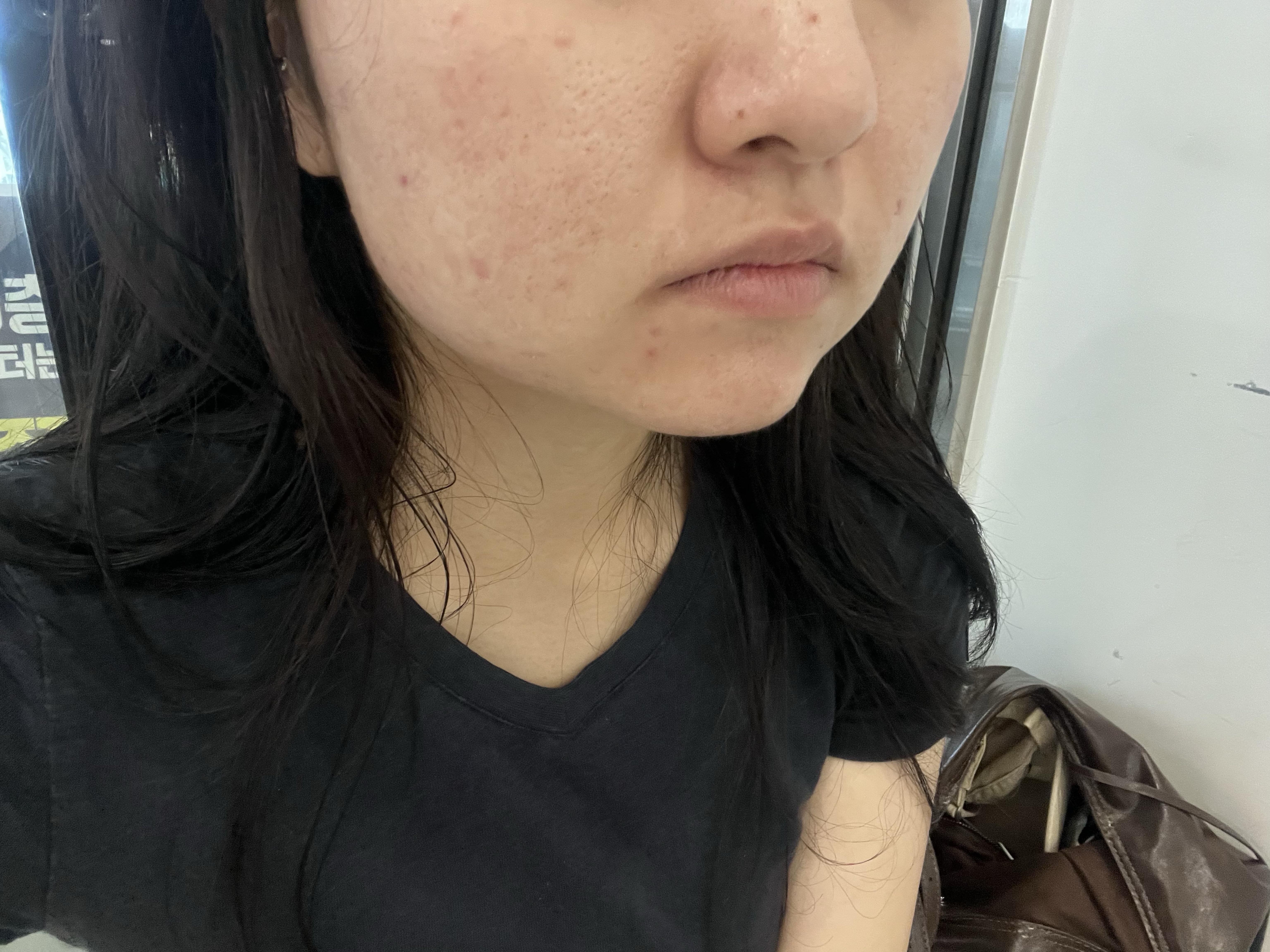 後