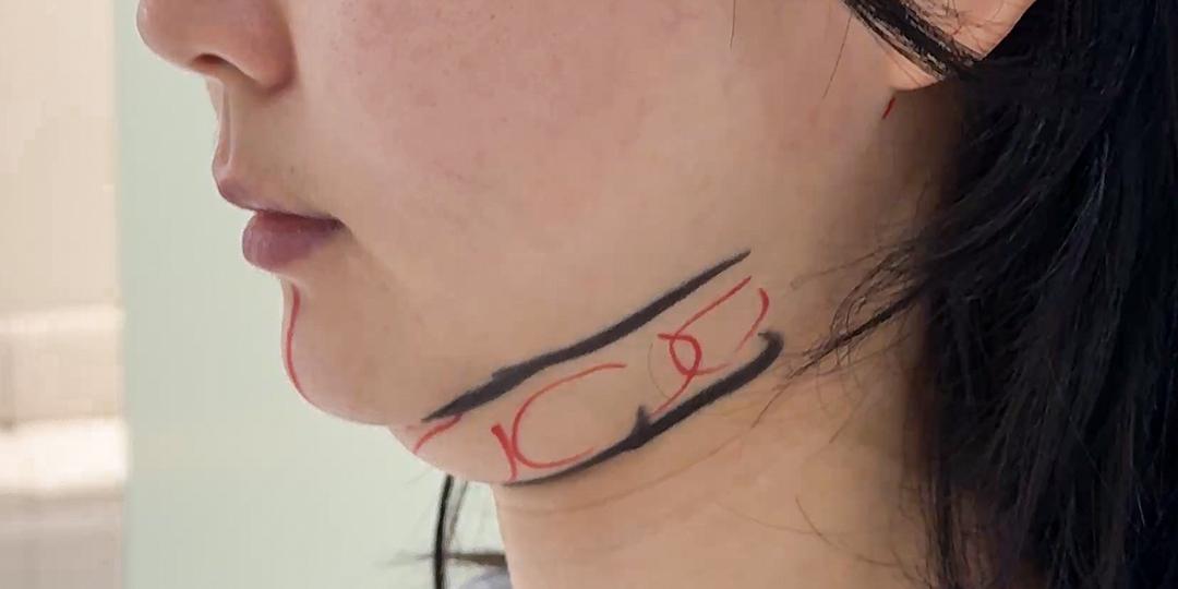 後