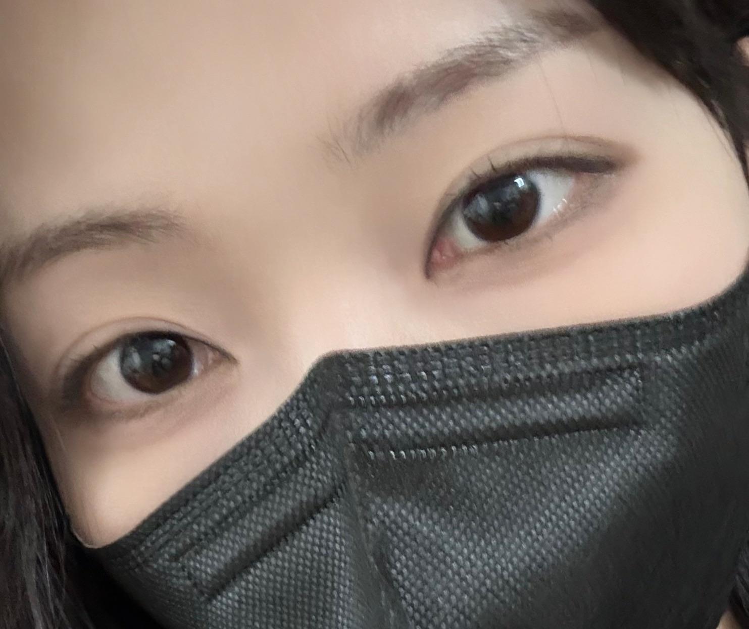 後