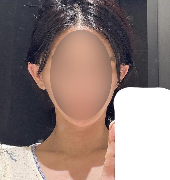 後