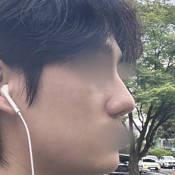 後