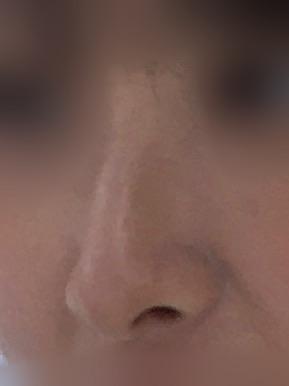 後