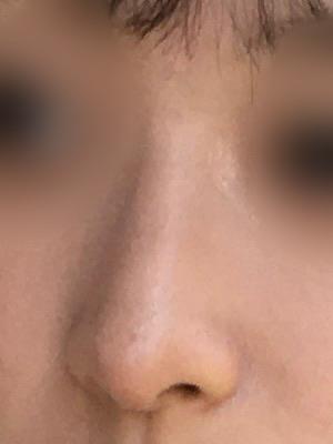 後