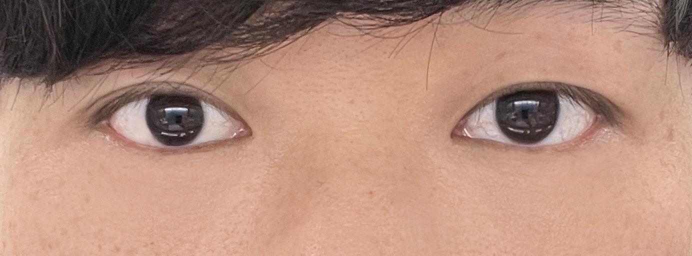 後